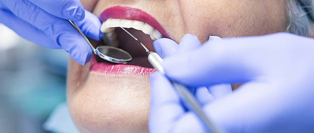 Best Emergency Broken Tooth Repair in Lincroft, NJ